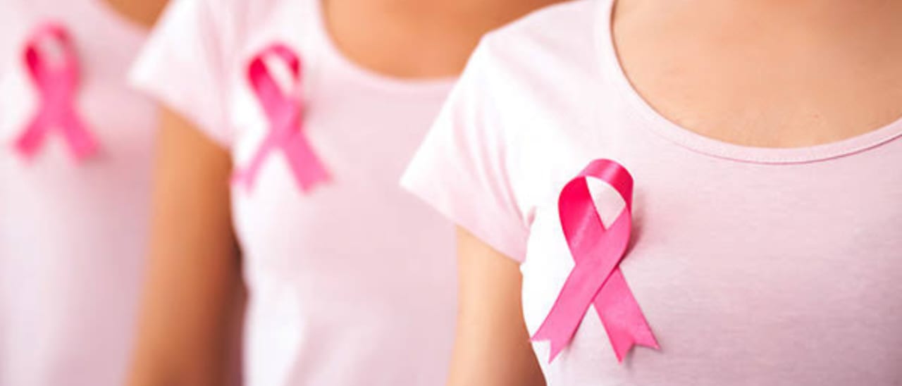 Breast Cancer: Causes, Symptoms, Diagnosis, and Prevention – A Complete Guide